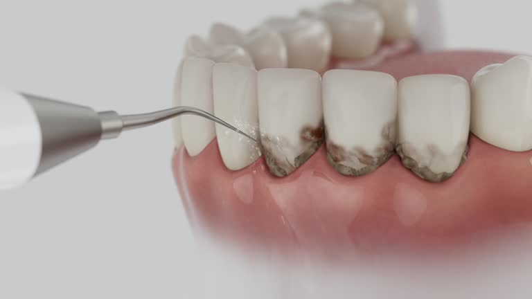 Trusted Teeth Whitening service in St. Clair Shores, MI - Dentist Open Now